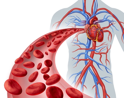 Carotid Artery Disease: Risk Factors and Symptoms