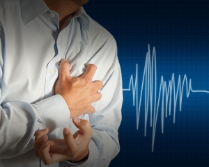 What is Myocardial Infarction?
