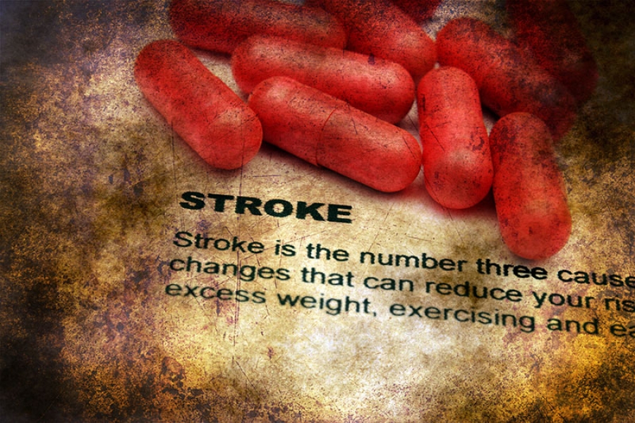 Everything You Need to Know About Stroke